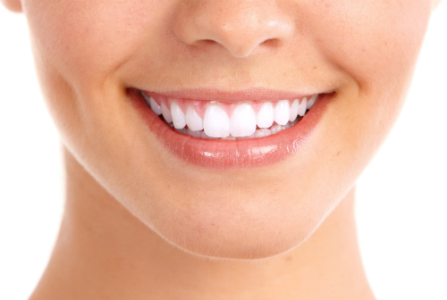 Teeth Whitening In Castle Hill: Considerations